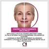 Q1 Q-Derm Intensive Anti-Wrinkle Cream for Women with Refreshing and