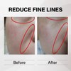Humanano, Eye Placen Solution Solution for Eye Serum, Intensive Care,