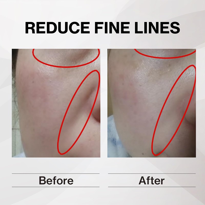 Humanano, Eye Placen Solution Solution for Eye Serum, Intensive Care,