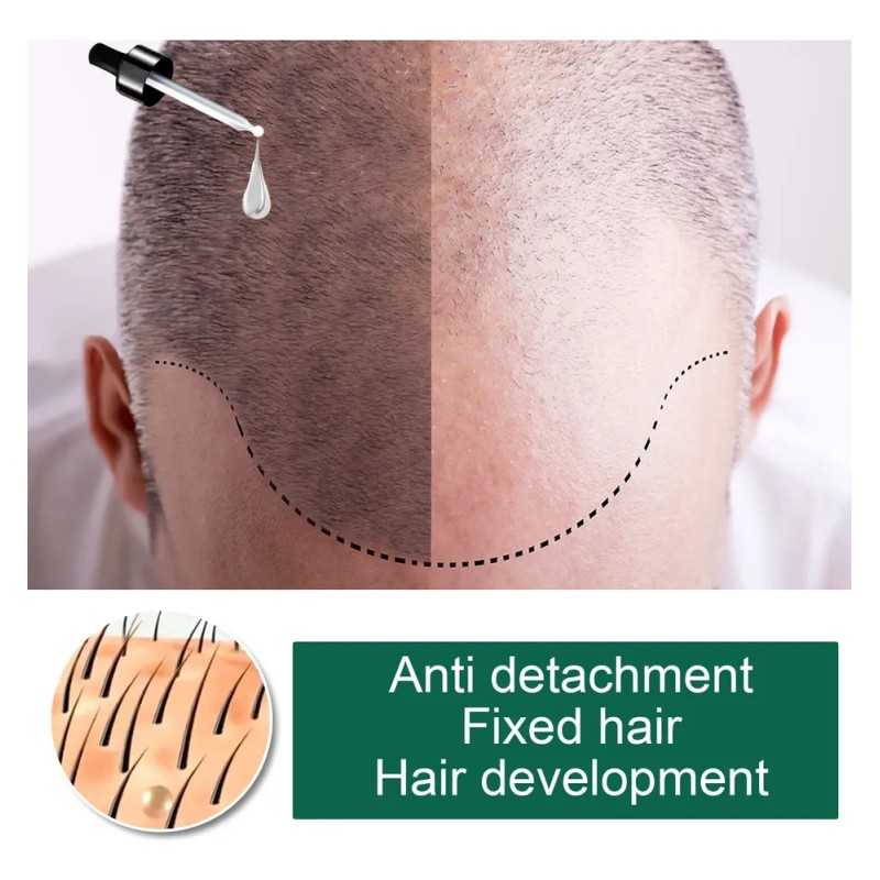 Eelhoe Suero Nutritivo De Jengibre Para Cabello 30