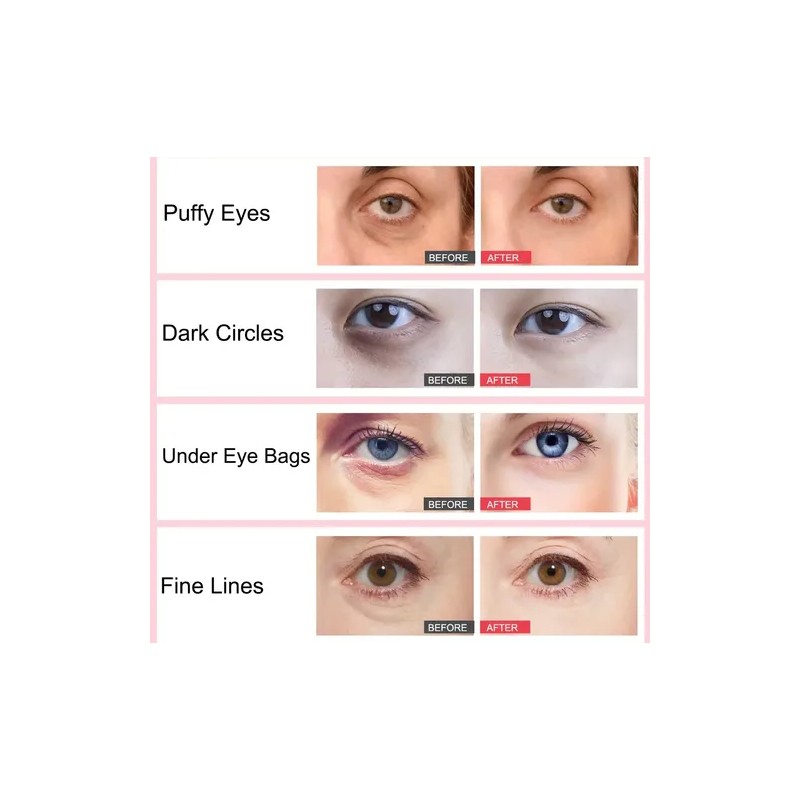 Crema Ojos Probiótica Antiinflamatorio Elasticidad Vegano