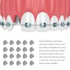 Healifty 30 botones linguales de ortodoncia dental con base redonda