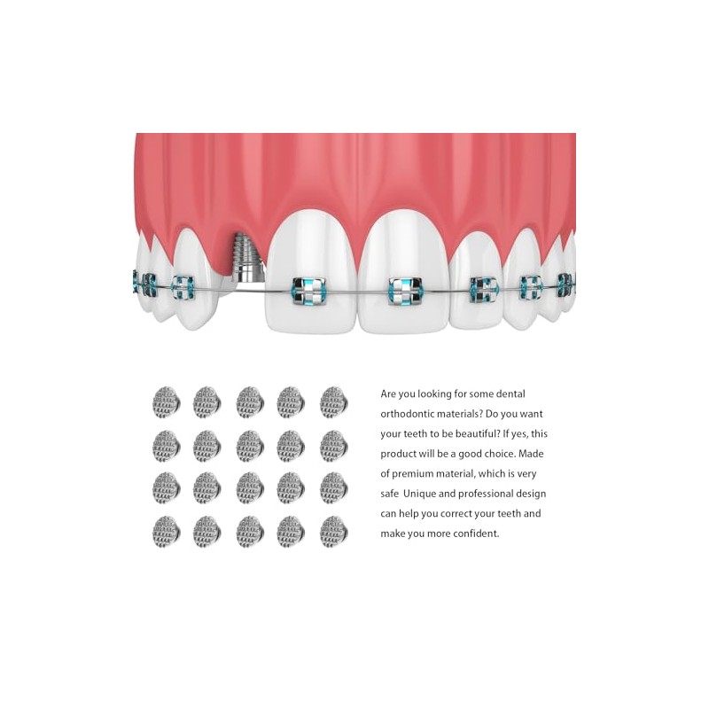 Healifty 30 botones linguales de ortodoncia dental con base redonda