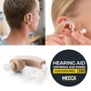 Hearing Aid Domes - Universal Domes for Hearing Aids -