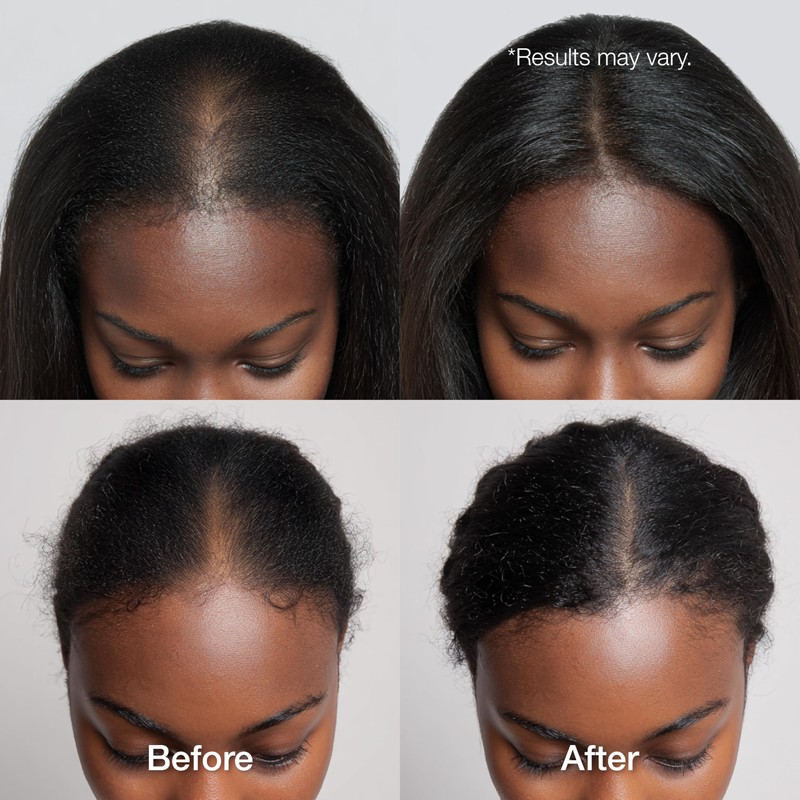 Lux Collection Miracle Growth Hair Oil Triple Strength Super Power