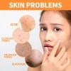 Mascarilla Clay Stick Q + V 40 G
