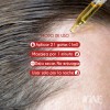 Tonico Al 10% Ignis Para Crecimiento De Barba 3 Pzas