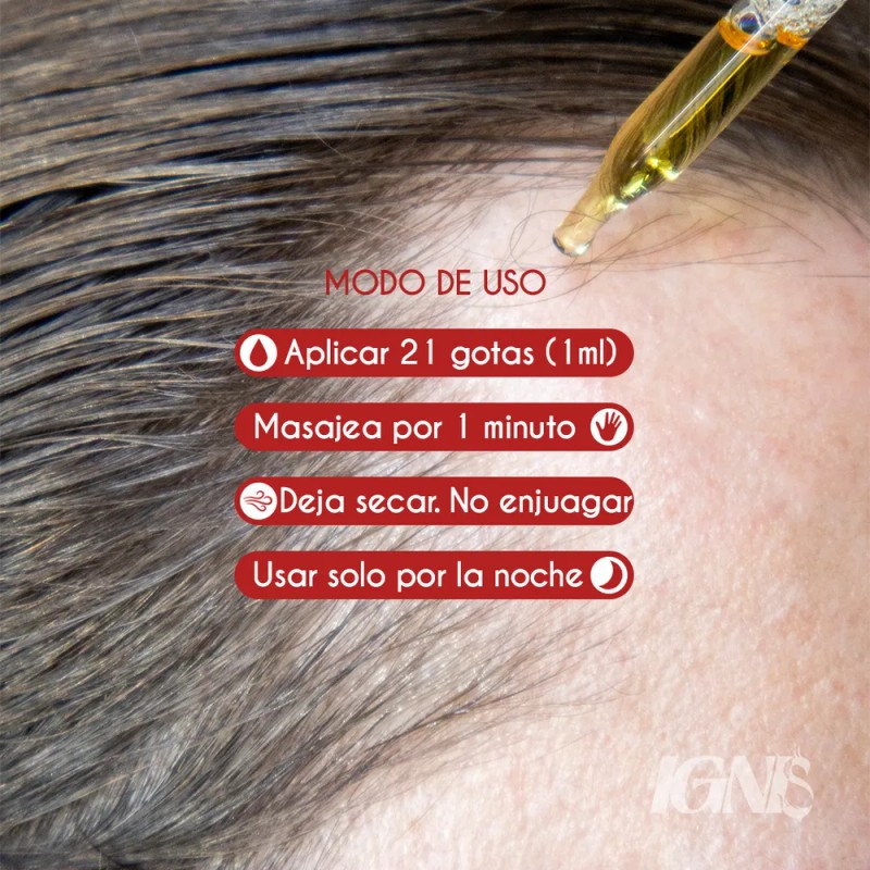 Tonico Al 10% Ignis Para Crecimiento De Barba 3 Pzas