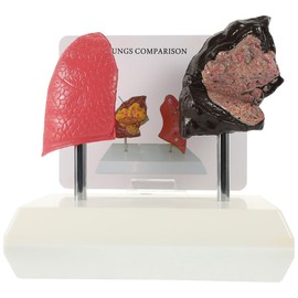 Cabilock Smoking Lung Model and Normal Lung Comparison - Realistic PVC Anatomy Model for Medical Teaching Education and Health Studies