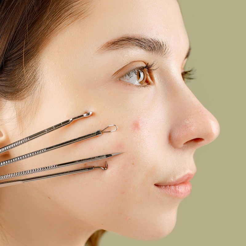 Qaixwuyi 7-Piece Tweezers Set, Blackhead Remover, Pimple Squeezing Tool with