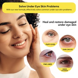 Lookix Under Eye Patches - 60 Pcs - Anti-Aging Collagen Eye Mask for Dark Circles, Puffiness & Wrinkles, Refreshes Skin