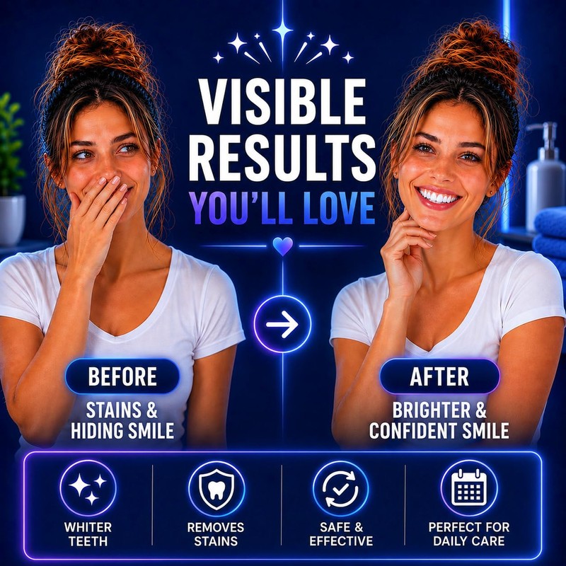 ZABERRY Teeth Whitening Kit with 2 x 10ml Gel +