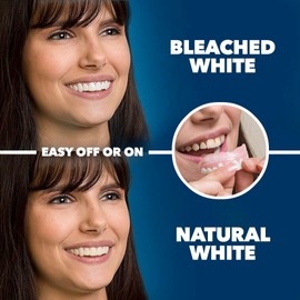 Imako Premium Cosmetic Teeth - 2 Pack - Large, Bleached White - Upper Veneers - Custom Fit at Home, DIY Smile Makeover - Made in USA