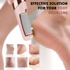 Electric Foot File - Foot Scrubber for Feet, Professional Pedicure
