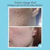 Salicylic Acid 20% Gel Peel - Enhanced with Tea Tree
