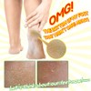 Elizavecca/Foot Peel /1 Foot Pack 2 Pairs Foot Mask -