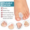 Welnove Pack of 14 Toe Separators, Gel Toe Spacers with