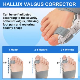 JLFDLLYYZQ Hallux Valgus Correction Set, 1 Piece Halux Valux Correction Splint Adjustable and 2 Pieces Correction Bandage Socks Bunion Corrector for Men and Women
