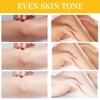 Peeling Oil for Dark Skin, Peeling Solution with Salicylic Acid,