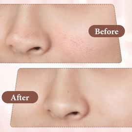 Yuanchu Pore Prep Tool, Blackhead Cleaning Tool Metal Pore Cleaning Tool Stainless Steel Pimple Extractor Skin Scrubber Spatula Pore Cleaner Face Scraper for Cleaning Stiring Smearing