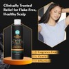DHS TAR SHAMPOO 8 OZ by DHS