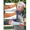 9 Pares Protectores de Brazos para Piel Fina y Hematomas
