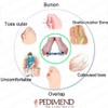 Pedimend™ Toe Belt | Bunion Exercise Aid Corrector Treatment |