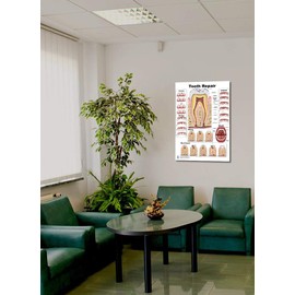 Tooth Repair Poster, Chart (PVC, Large 24x36)