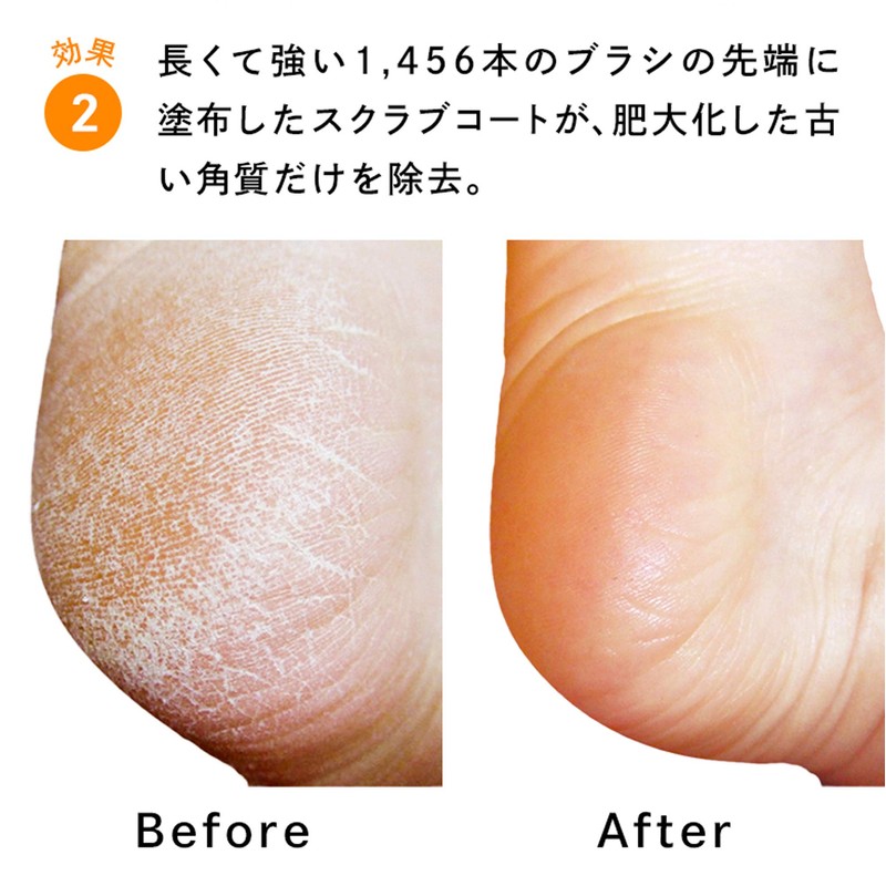 Foot Groomer Grand (Star White) Sunpack Scrub Coating Foot Brush