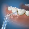 Waterpik JT-100E Classic Jet Nozzles 2 Tips