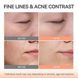 TOUCHBeauty LED Beauty Face Mask - Coco Brown