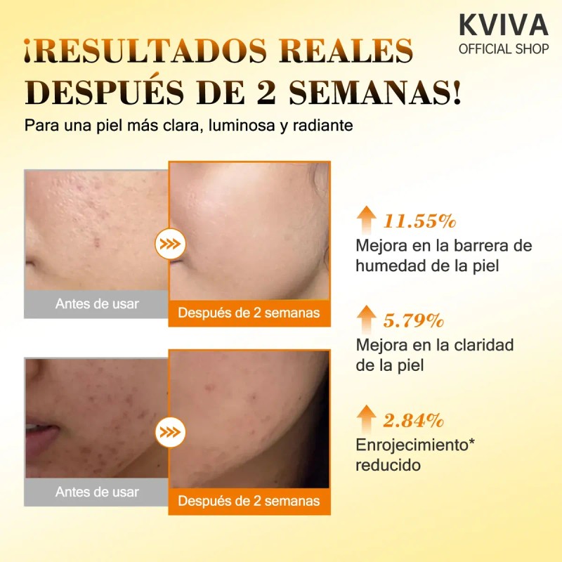 Medicube Sérum Iluminador Ácido Kójico Niacinamida 30ml