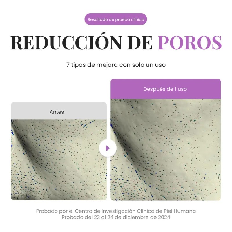 Eqqualberry Purple Rice Pore Purifying Limpiador Facial