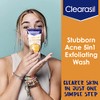 Clearasil Limpiador Facial Exfoliante Stubborn Acne Control 5 en1 200