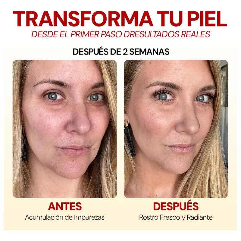 Kit Limpieza Total Skincare Seyoul 4 Pzs Rutina Facial