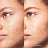 CLEANSER BB ACNE CLARIFYING