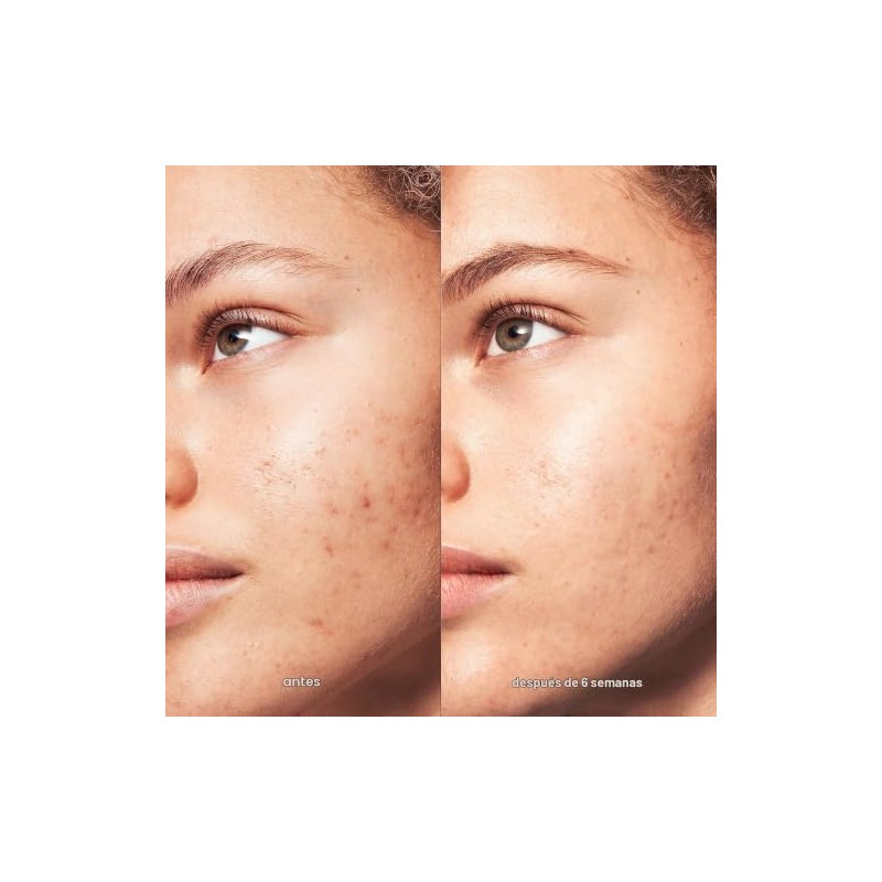 CLEANSER BB ACNE CLARIFYING