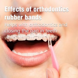 Orthodontic Elastic 500 bandas de goma dentales (medianas, 3.5 onzas, 1/8, ardilla), bandas de goma ortodóntica Teckolign, paquete de 500, suministros de ortodoncia, ideal para rastas, trenzas, brecha