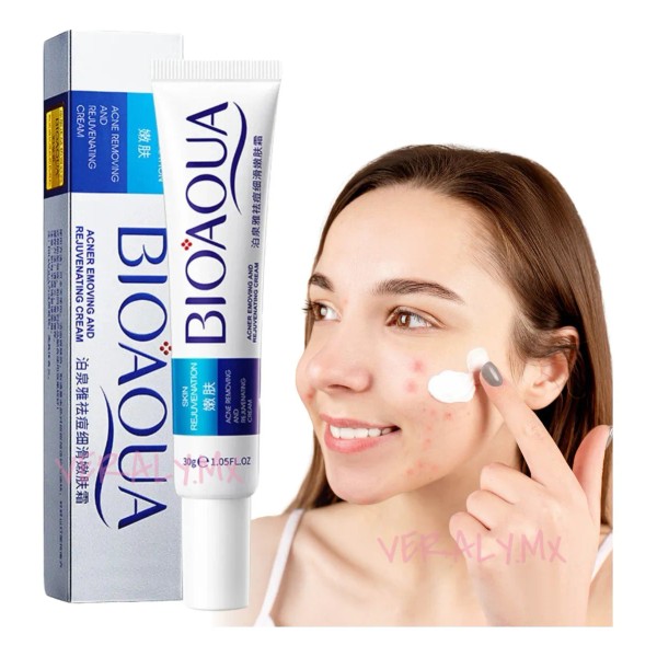 Bioaqua Acne Crema Cicatrices Poros Control De Grasa Full Momento