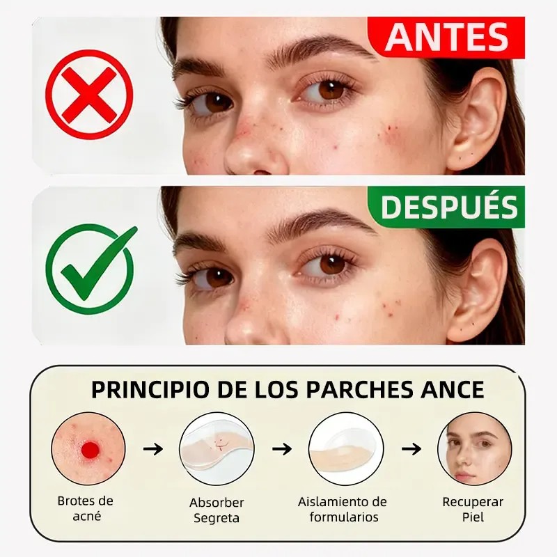 Lusabe Parches Para Acné Invisibles 36pzs Pimple Patch