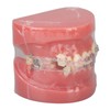 Demonstration Orthodontics Dental Model Disassembled Resin Teeth Model for Teaching