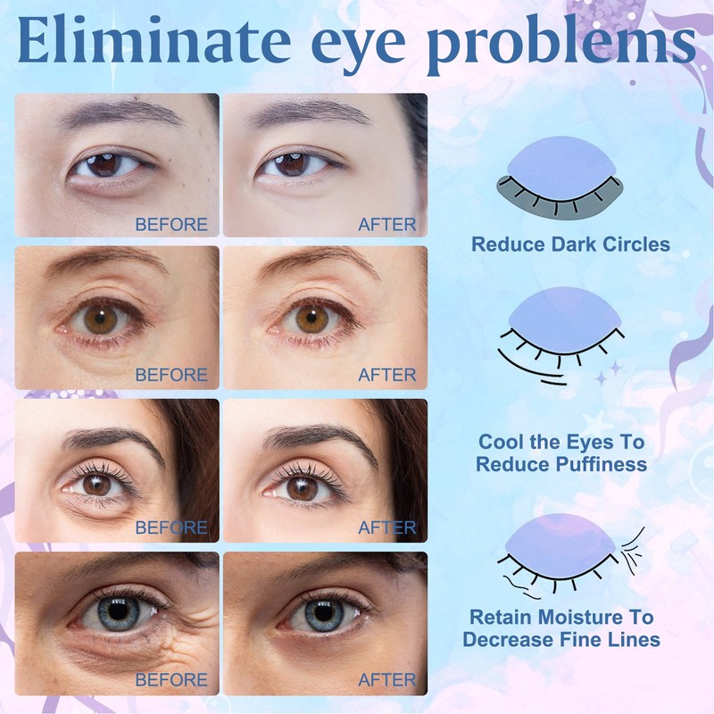 18 Pairs Collagen Under Eye Mask Moisturizing Dark Circles Removal