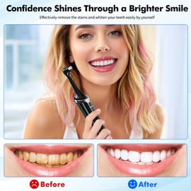 Hapycat Electric Tooth Polisher, 5 Speed Modes, LED Light, 6 Cleaning Heads, USB-C Charging, IPX6 Waterproof, Black