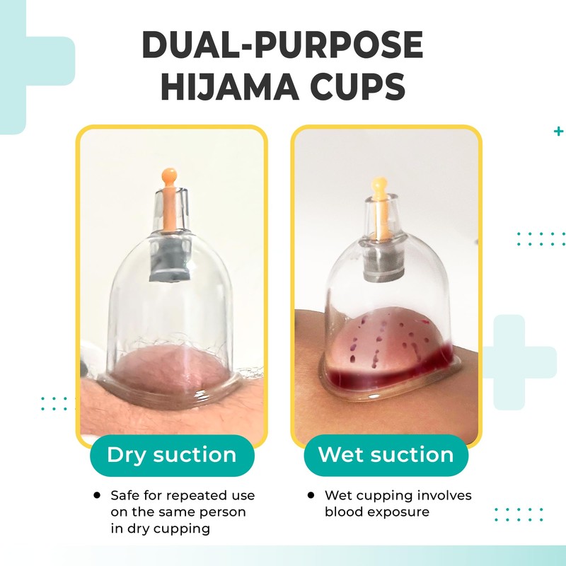 [100 Pack] Bulk Hijama Cups for Cupping - B1 B2
