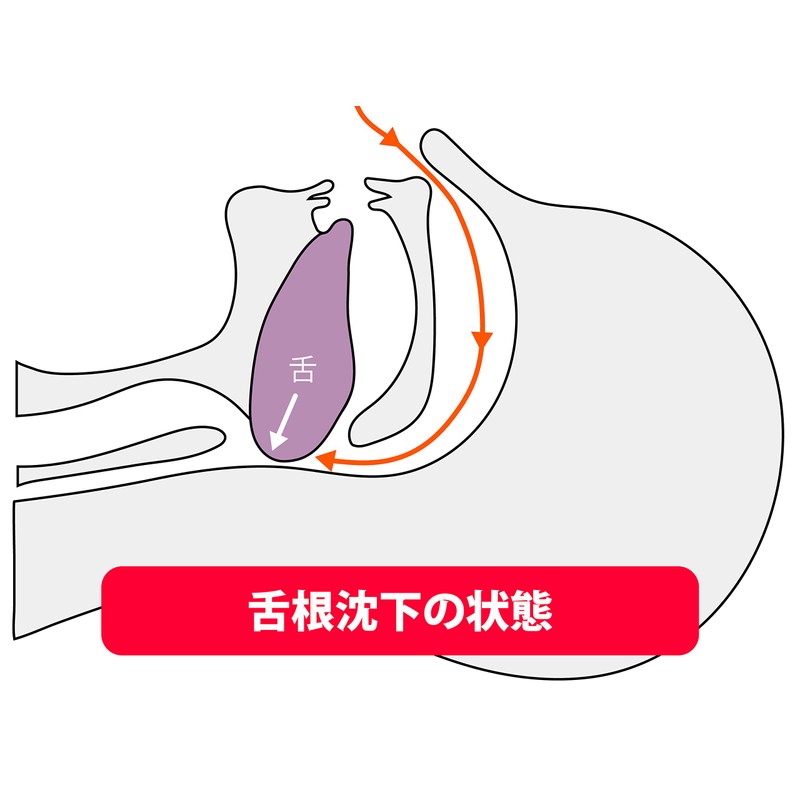 【新方式！無呼吸症候群・いびき防止グッズ】お手軽！口呼吸ストップ！イムニタスマスク（頭がけ） (1)