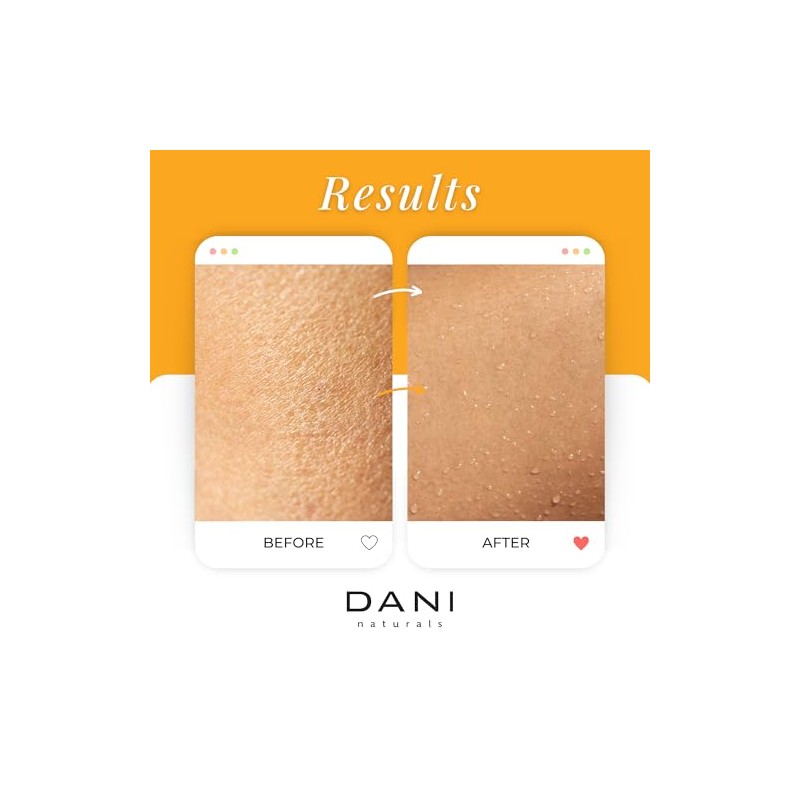 DANI - Exfoliante de azúcar natural, 14 oz