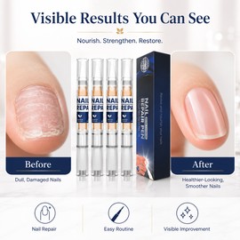 4-Pack Nail Care Liquid Pens for Women – Portable Nail Repair Pens for Daily Toenail & Fingernail Care