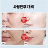 [100% 제거] 레티놀 팔자주름패치 팔자주름없애기 미간 입가 눈가 주름개선 패치