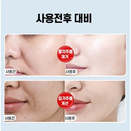 [100% 제거] 레티놀 팔자주름패치 팔자주름없애기 미간 입가 눈가 주름개선 패치 안티에이징 리프팅 패치 LUPEIYA, 10개입, 4개 100% Removal Retinol Laugh Line Patches - Anti-Aging Lifting Patches for Forehead, Mouth, and Eye Wrinkle Improvement - LUPEIYA, 10 pieces, 4 packs