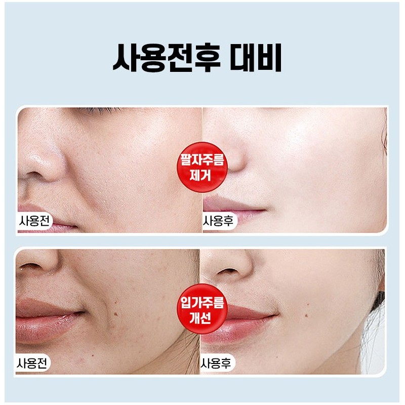 [100% 제거] 레티놀 팔자주름패치 팔자주름없애기 미간 입가 눈가 주름개선 패치